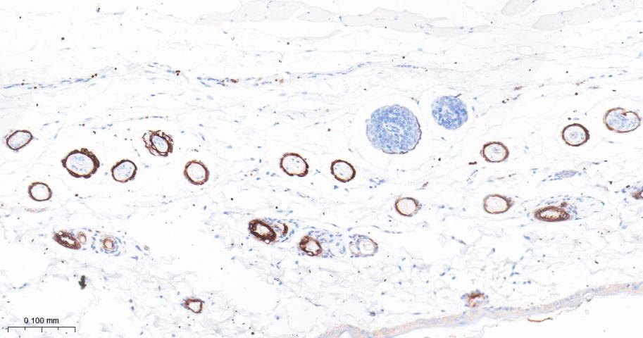 细胞角蛋白17重组兔单抗