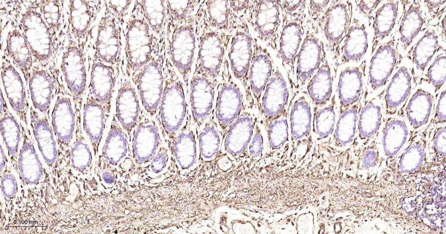 热休克蛋白27重组兔单抗