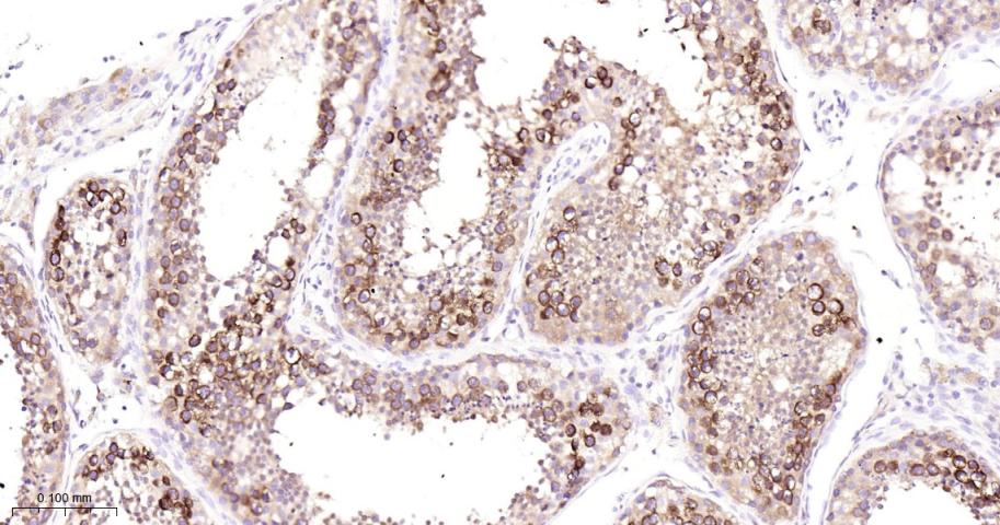 组蛋白去乙酰化酶6重组兔单抗-bsm-52086R