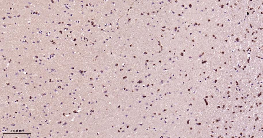 热休克蛋白-70重组兔单抗