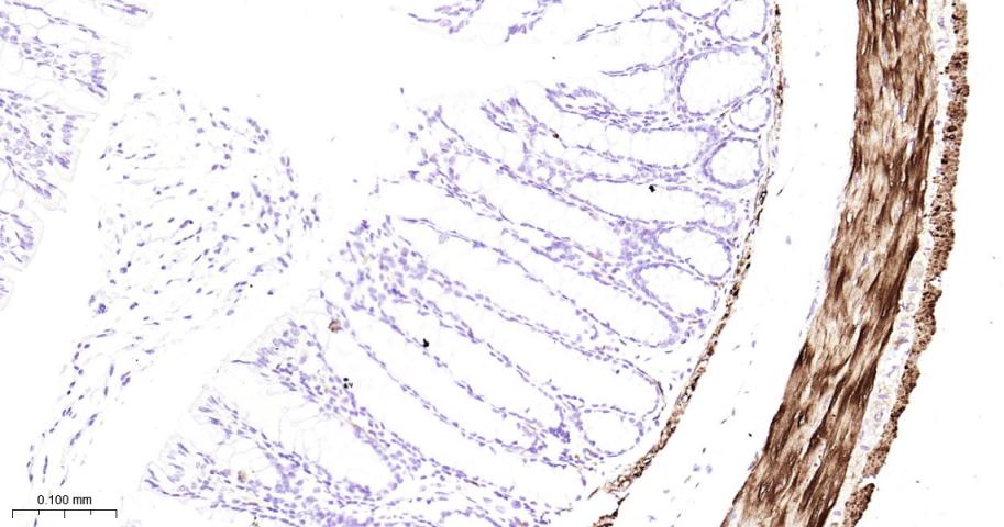 热休克蛋白27重组兔单抗