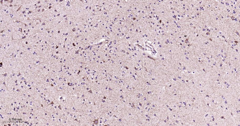 细胞色素c氧化酶IV重组兔单抗