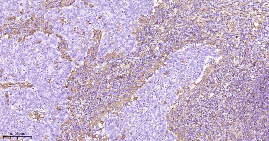 热休克蛋白27重组兔单抗