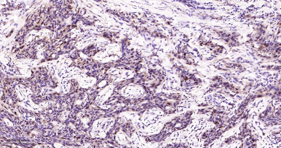 热休克蛋白-70重组兔单抗