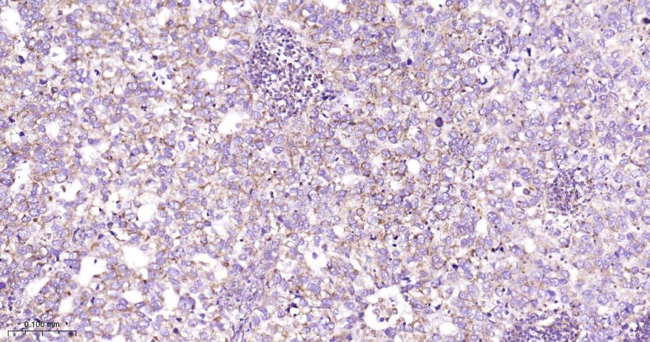 细胞色素c氧化酶IV重组兔单抗