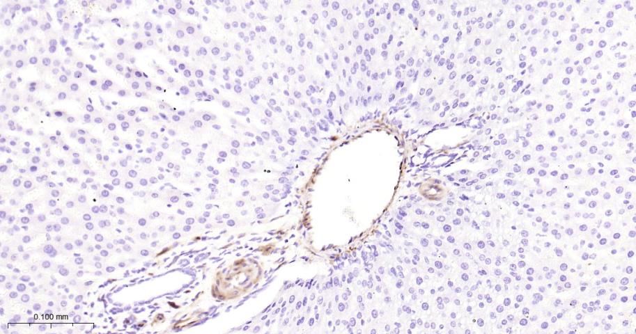 热休克蛋白27重组兔单抗