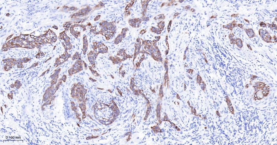 细胞角蛋白17重组兔单抗