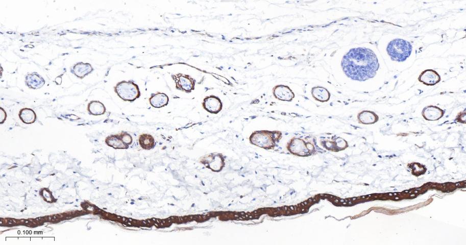 细胞角蛋白1重组兔单抗