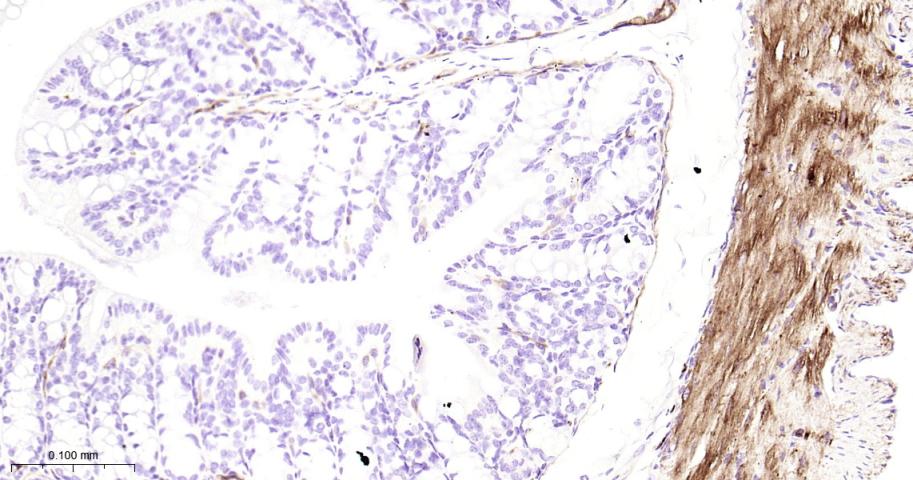热休克蛋白27重组兔单抗