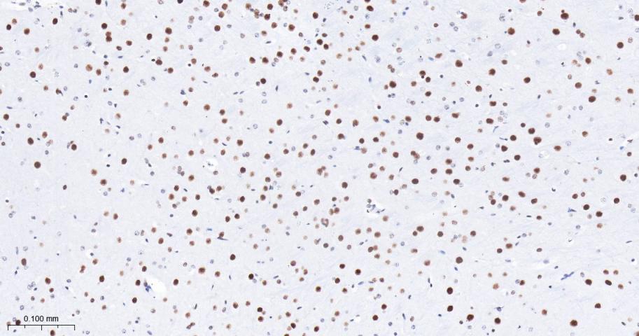 组蛋白去乙酰化酶1（核内参）重组兔单抗