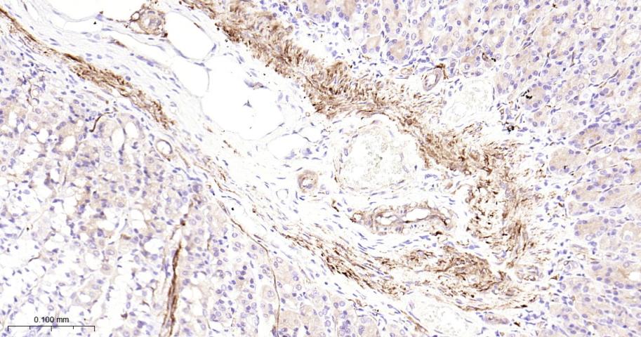 热休克蛋白27重组兔单抗