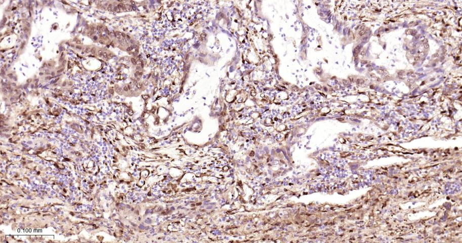 热休克蛋白27重组兔单抗