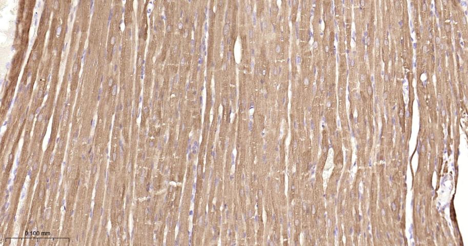 热休克蛋白27重组兔单抗