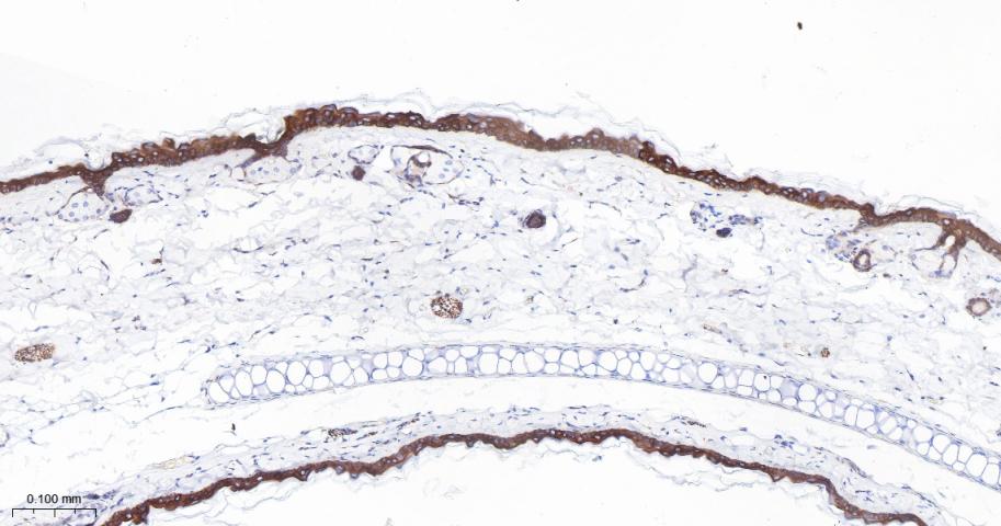 细胞角蛋白1重组兔单抗