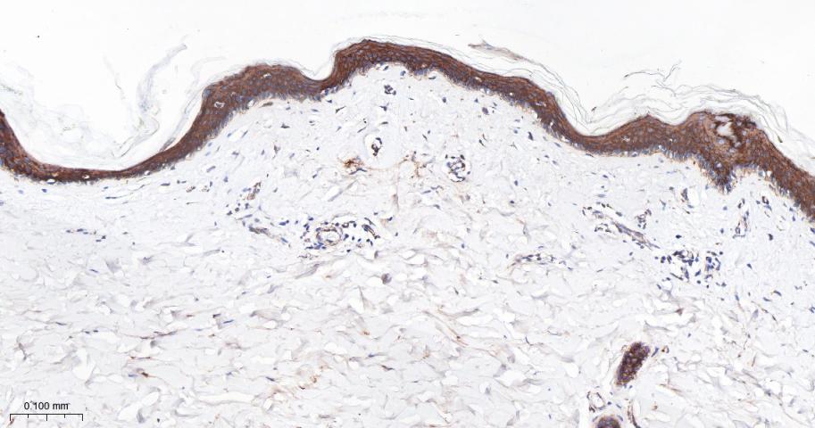 细胞角蛋白1重组兔单抗