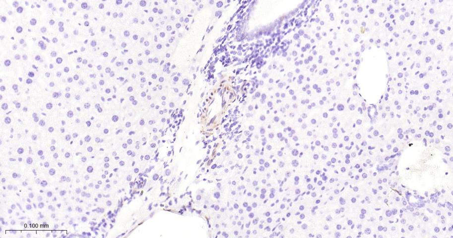热休克蛋白27重组兔单抗