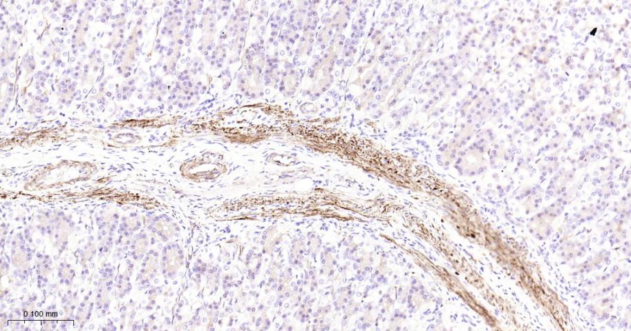 热休克蛋白27重组兔单抗