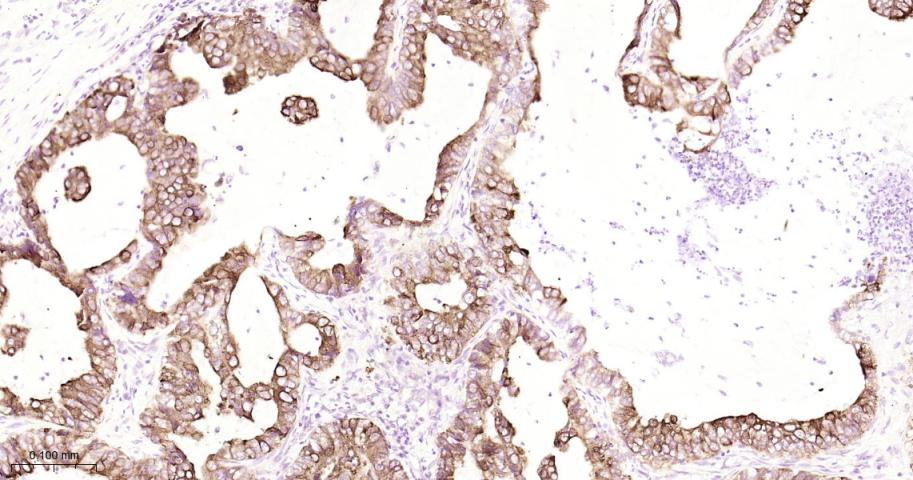 前梯度同源蛋白2重组兔单抗