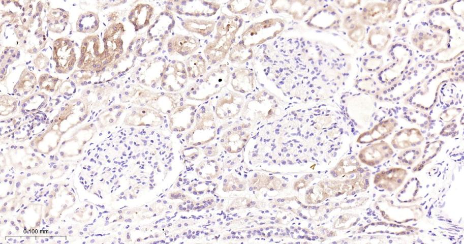 组蛋白去乙酰化酶6重组兔单抗-bsm-52086R