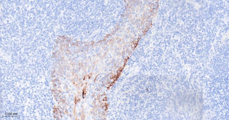 细胞角蛋白17重组兔单抗