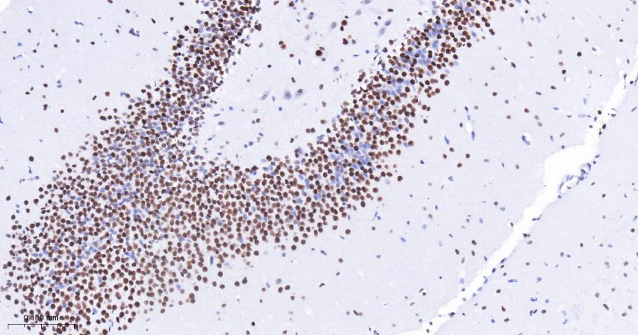 组蛋白去乙酰化酶1（核内参）重组兔单抗