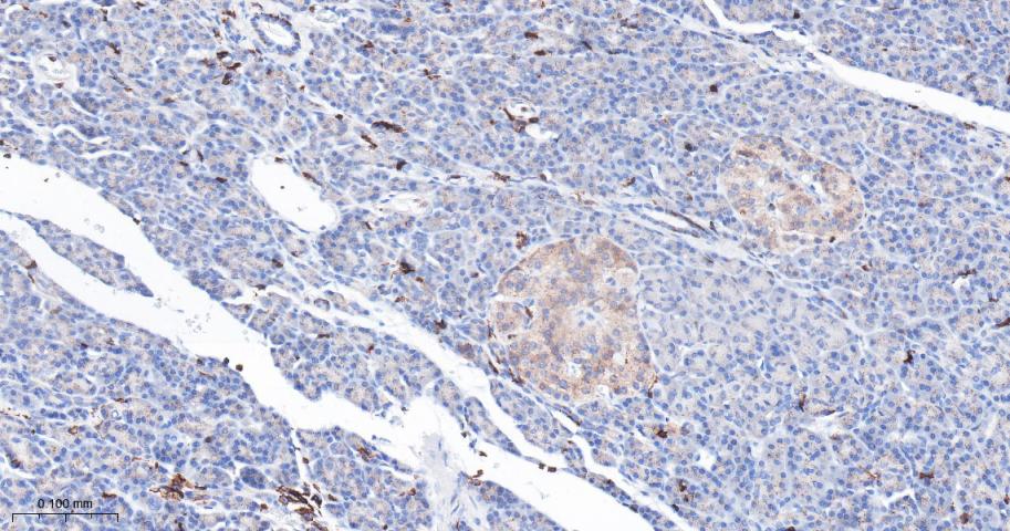 IFT88重组兔单抗
