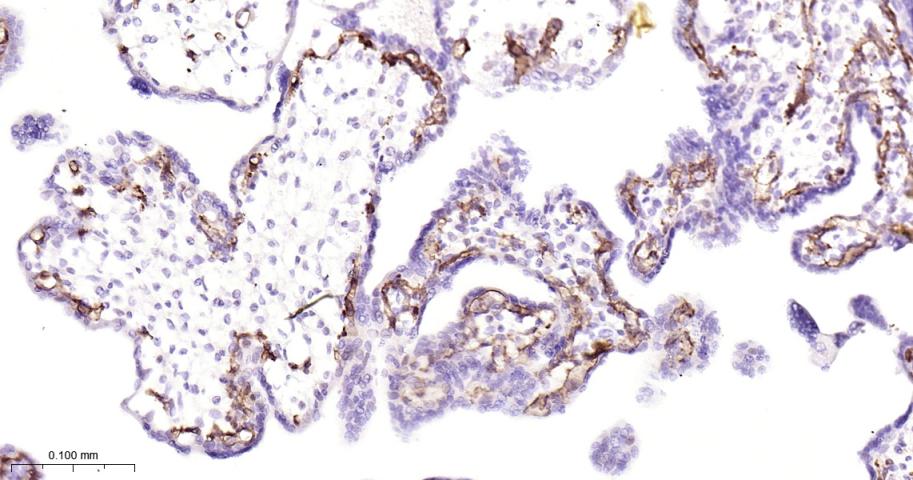 血管内皮生长因子受体2重组兔单抗