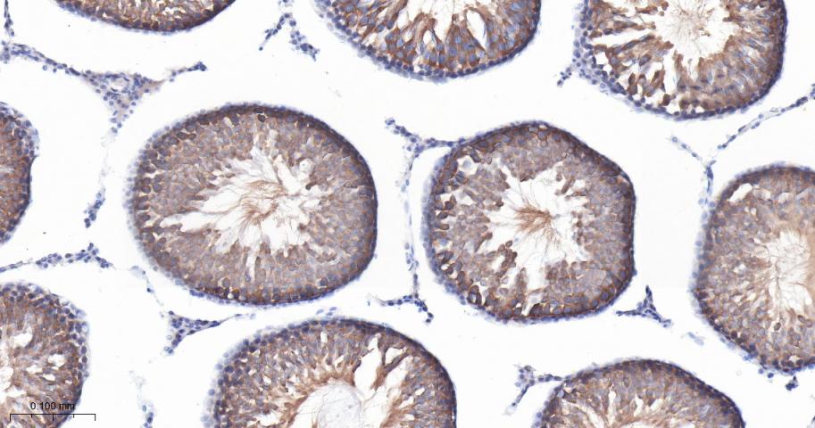 IFT88重组兔单抗