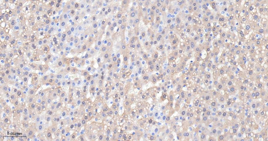 谷草转氨酶重组兔单抗-bsm-63078R