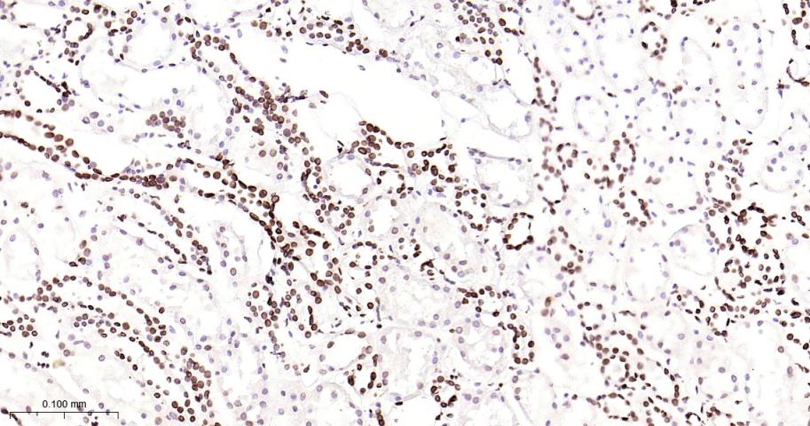 核纤层蛋白B2重组兔单抗