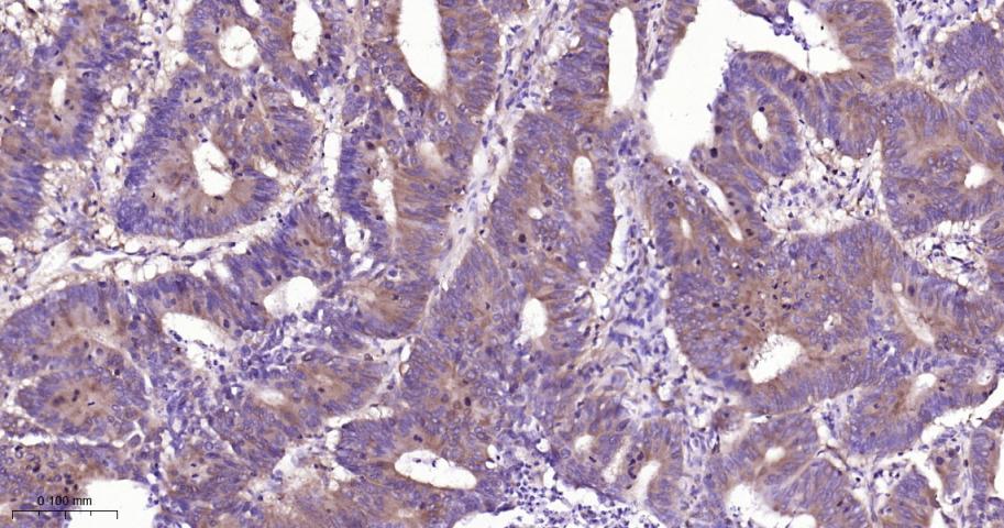 细胞核因子/k基因结合核因子单克隆抗体-bsm-33059M