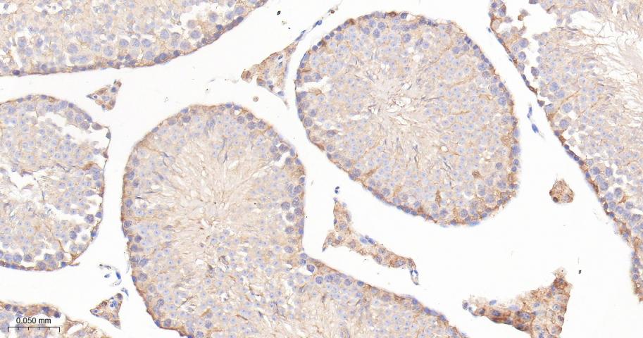 泛素激活酶E1重组兔单抗