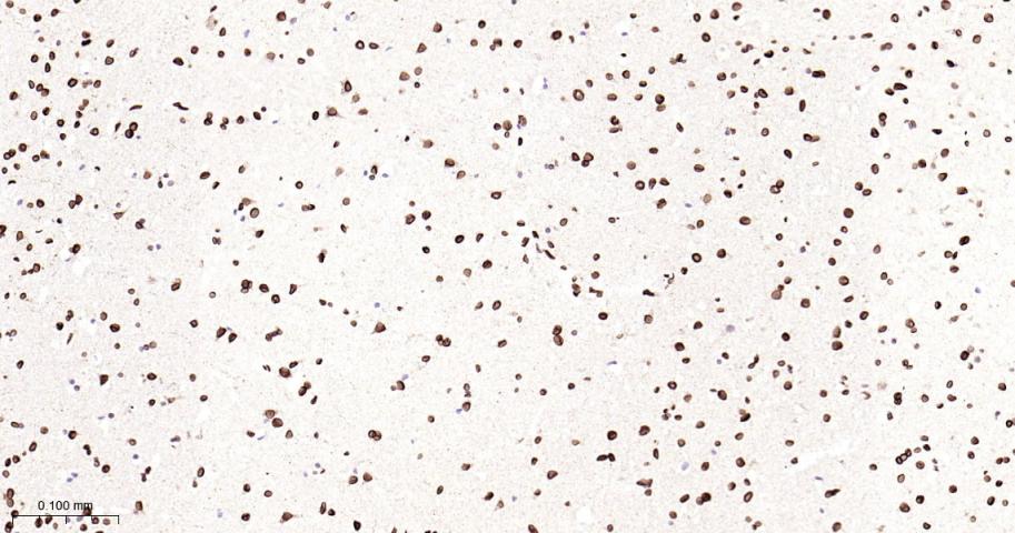 核纤层蛋白B2重组兔单抗