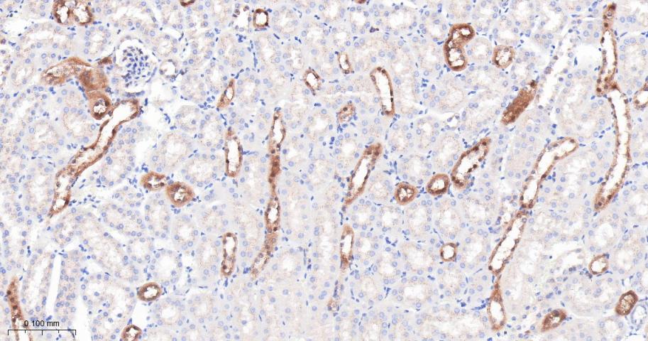IFT88重组兔单抗