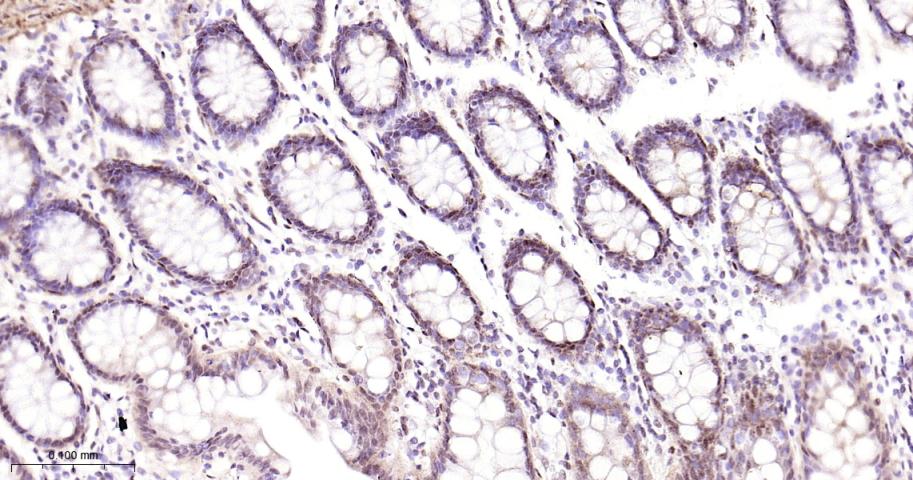 C端结合蛋白1重组兔单抗-bsm-61953R