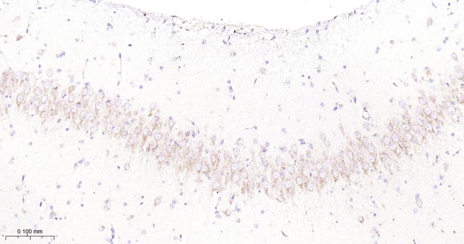 β-葡萄糖脑苷脂酶重组兔单抗-bsm-52907R