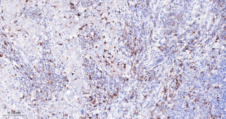 凋亡抑制因子1重组兔单抗-bsm-61518R