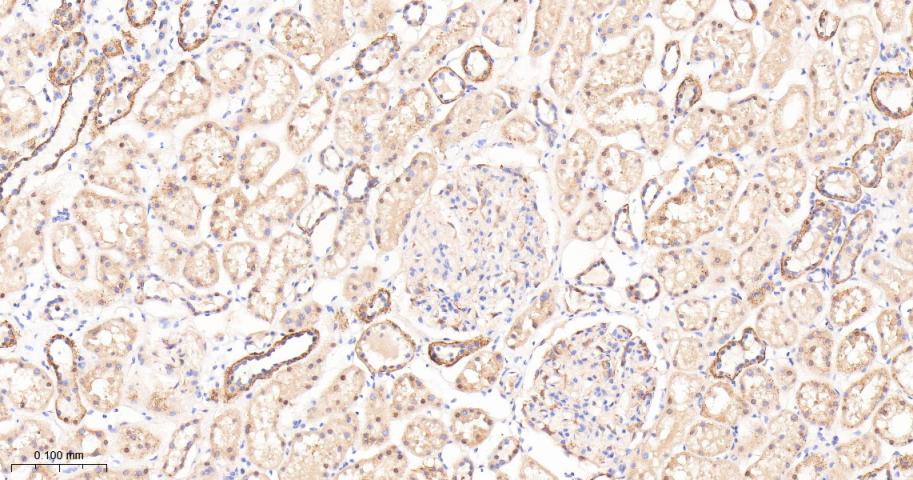泛素激活酶E1重组兔单抗