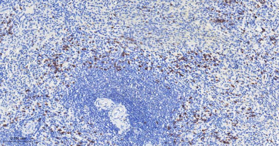 凋亡抑制因子1重组兔单抗-bsm-61518R