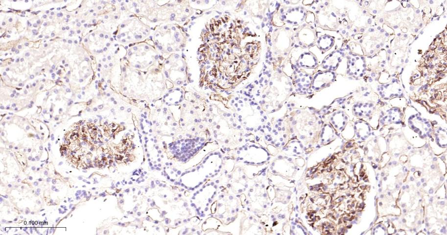 血管内皮生长因子受体2重组兔单抗