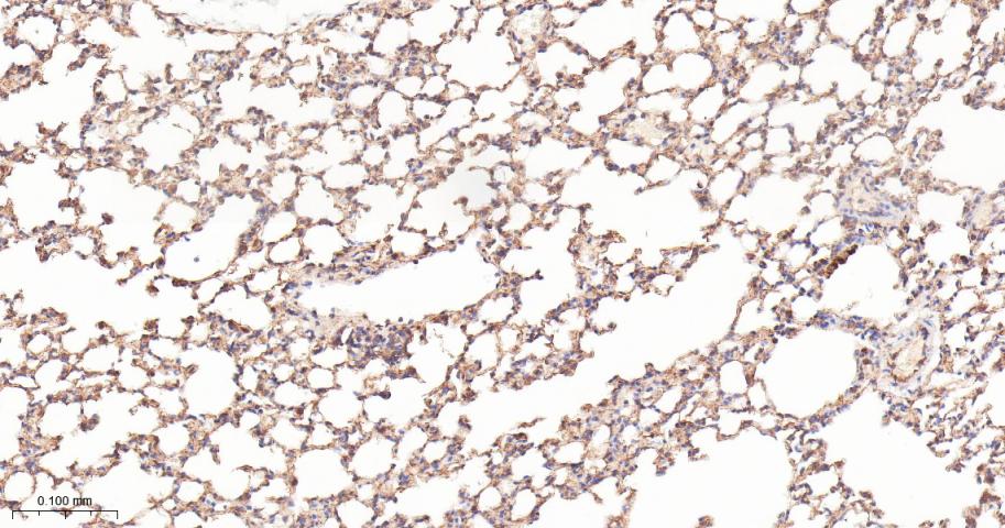 泛素激活酶E1重组兔单抗