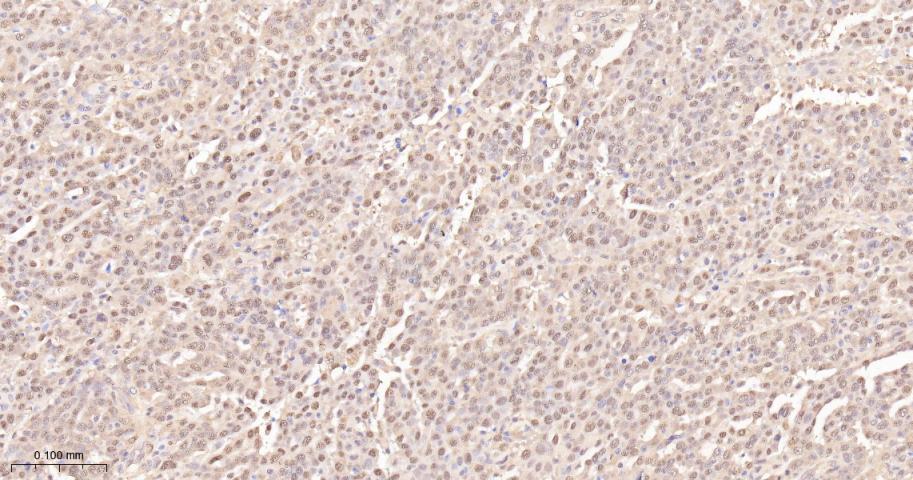 泛素激活酶E1重组兔单抗