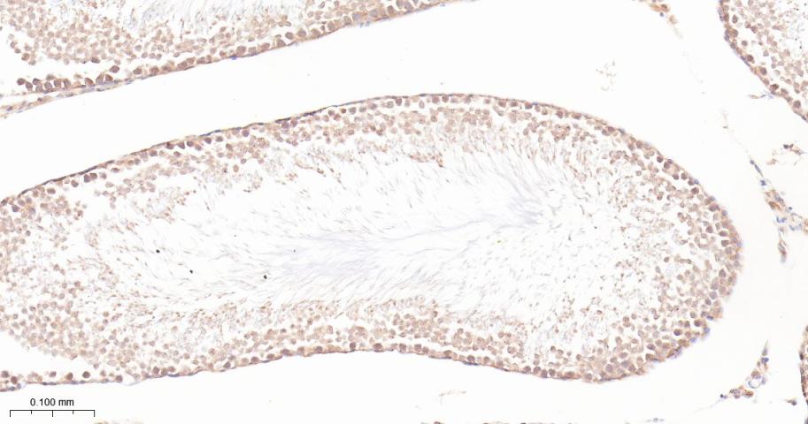 泛素激活酶E1重组兔单抗