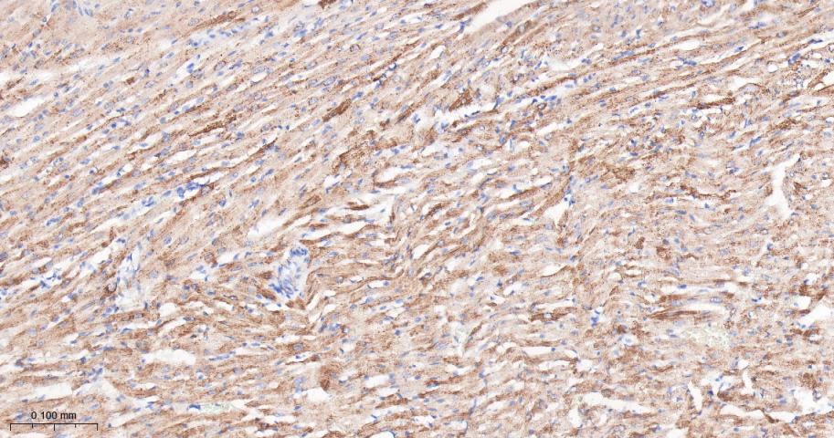 谷草转氨酶重组兔单抗-bsm-63078R