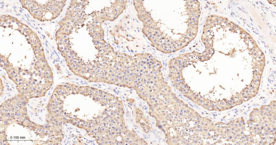 泛素激活酶E1重组兔单抗