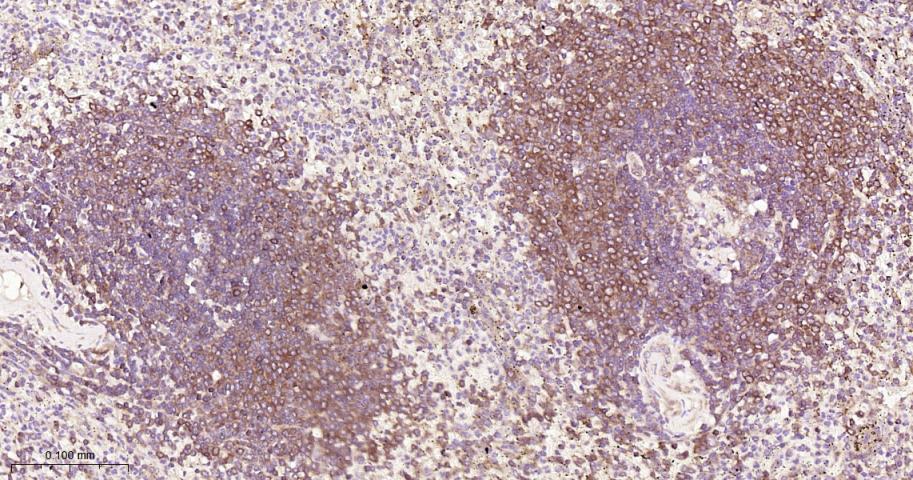 细胞核因子/k基因结合核因子单克隆抗体-bsm-33059M