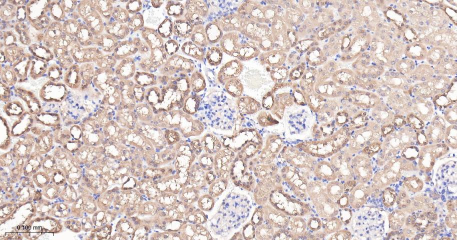 谷草转氨酶重组兔单抗-bsm-63078R