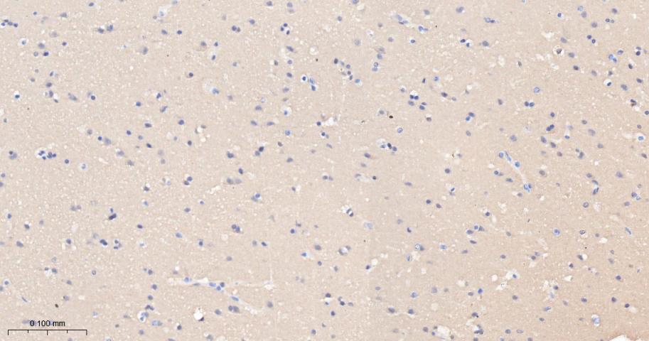 谷草转氨酶重组兔单抗-bsm-63078R