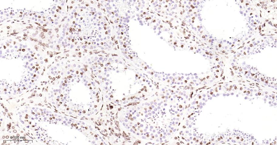 核纤层蛋白B2重组兔单抗