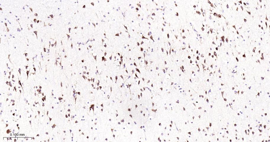 β-葡萄糖脑苷脂酶重组兔单抗-bsm-52907R